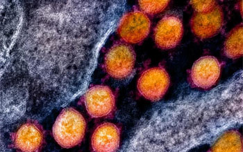 《自然》子刊：新冠由鼻入腦！科學家首次通過尸檢發現，新冠病毒或能從鼻子經過神經細胞進入大腦丨科學大發現